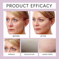 Xinyig Bio Real Deep Lifting Mask,Collagen Face Masks Skincare Sheet for Woman,3D L/ifting C/ollagen Full Face Tension Gel M/ask,Deep Co/llagen Anti Wrinkle Lifting Ma/sk,Overnight Collagen Fa/ce Mask