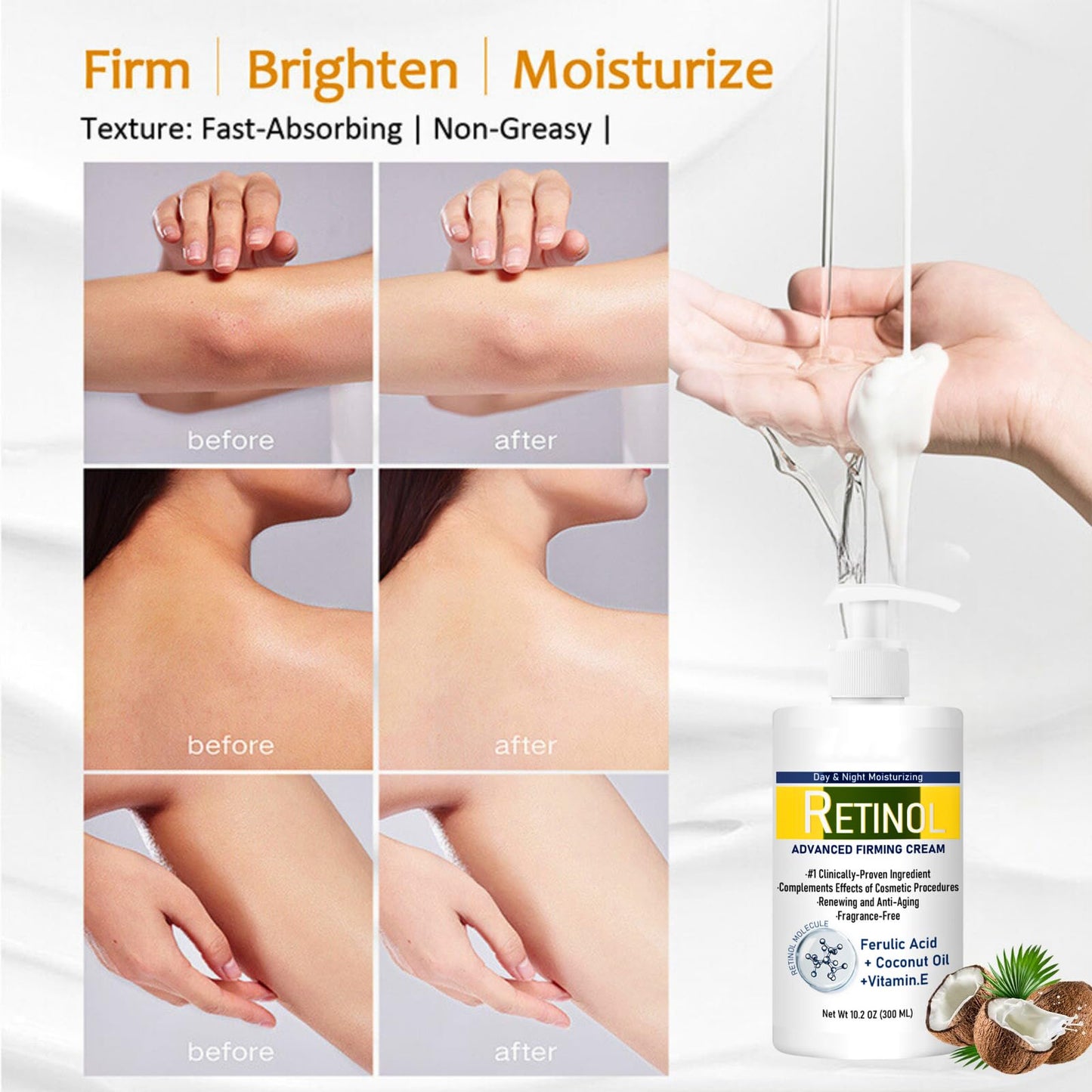 Trendyfave 300ml Retinol Body Lotion, Advanced Retinol Cream, Large-capacity Retinol Firming Body Cream with Cocount Oil and Vitamin E, Remove Dark Spots, Moisturizing Body Lotion for Dry Skin, Smooth Body Skin