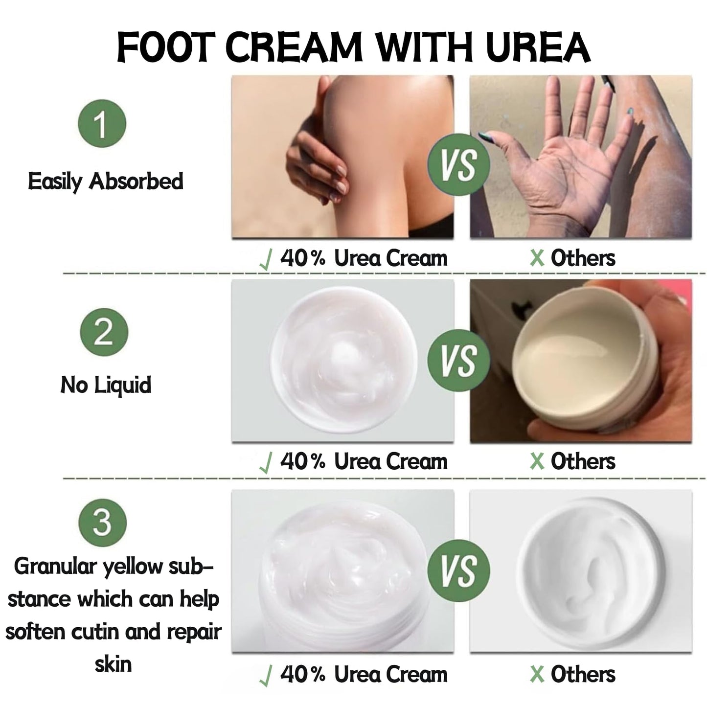 IZBEAUVO 40% Urea Foot Cream for cracked heels and Dry Skin – Cracked Heel Repair Cream & Intensive Foot Moisturiser – Targets Rough Skin Areas & Dry Feet Treatment - Suitable for all kinds of seasonal dryness