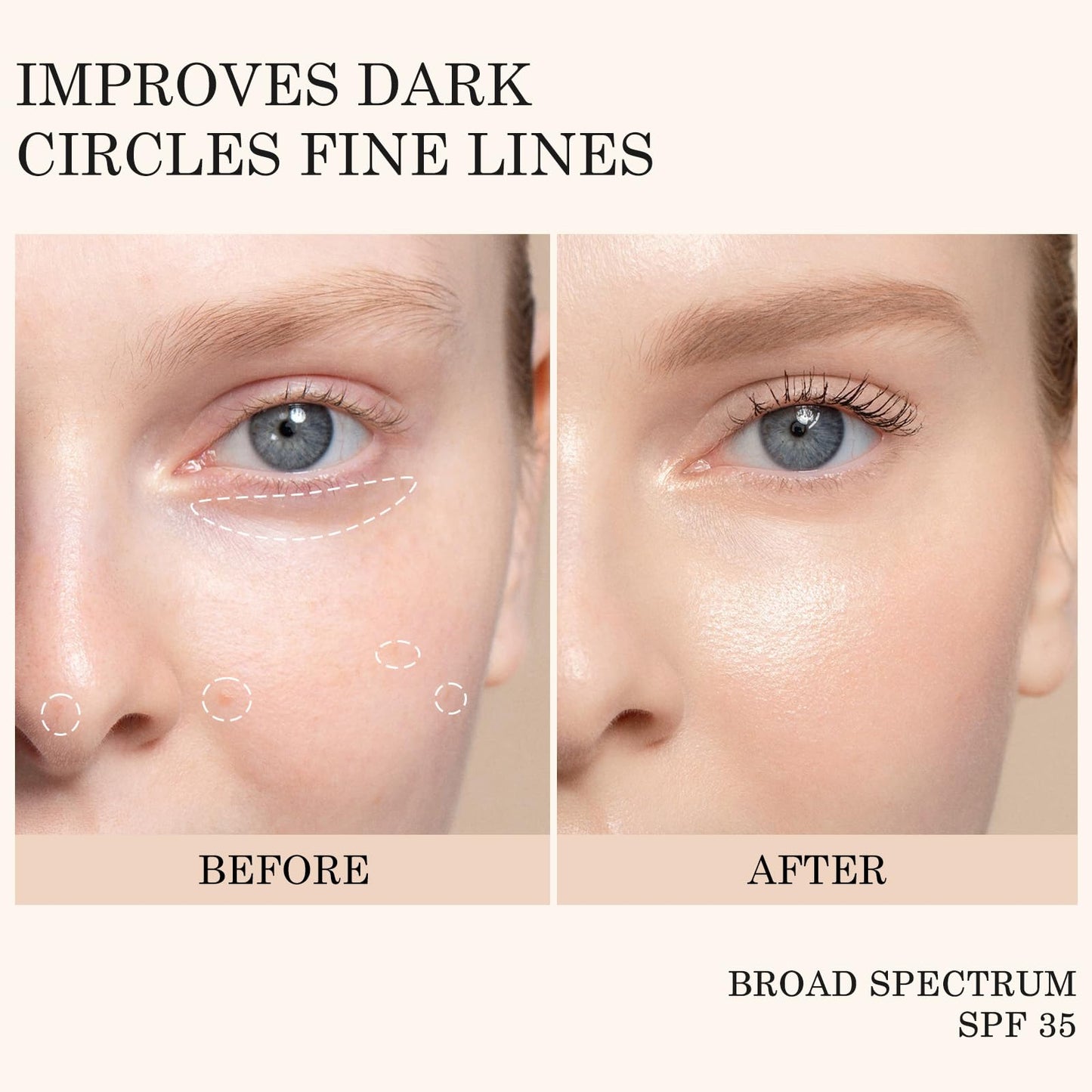 KYDA Mineral Sunscreen Eye Cream, Packaging Upgrade, 3-in-1 Anti-Aging Under Eye Cream for Dark Circle and Fine Lines, SPF 35, Light