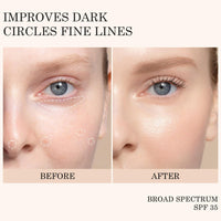KYDA Mineral Sunscreen Eye Cream, Packaging Upgrade, 3-in-1 Anti-Aging Under Eye Cream for Dark Circle and Fine Lines, SPF 35, Light