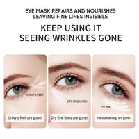 60 Pcs Under Eye Treatment Masks,HOUSN Under Eye Gel Patches for Dark Circles,Collagen Under Eye Mask,Hydrate, Moisturise, Improve Lines and Wrinkles Eye Care Skincare for Puffy Eyes(Gold)