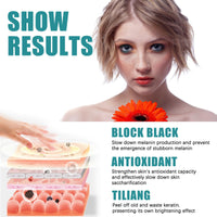 Nadiaen 2 Pcs Dark Spot Remover for Face,Age Spot Remover Hyperpigmentation Treatment-Sun Spots and Melasma Treatment Cream for Face, Pigmentation Freckle Removal Cream