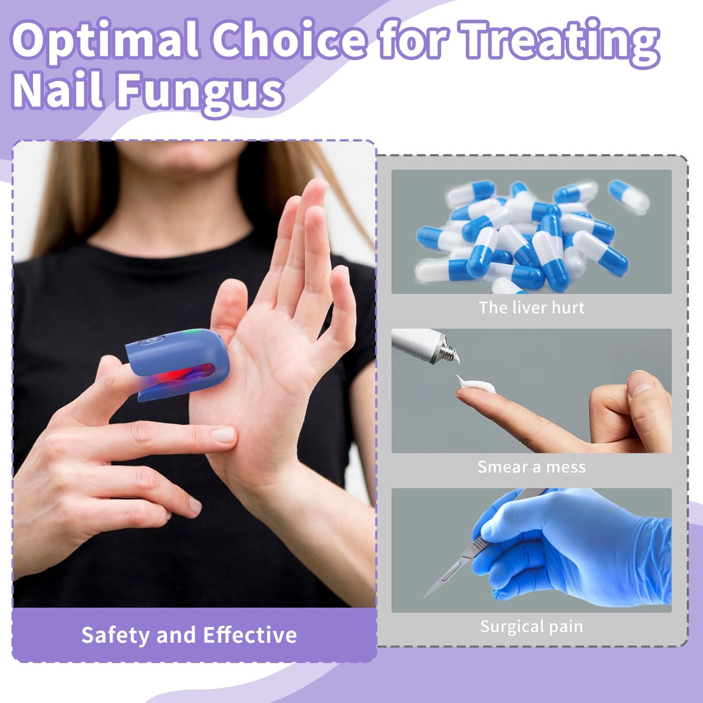 HaSoCare Nail Fungus Device, Fungal Nail Treatment, Antigungal Device for Toenail Fingernail and Onychomycosis