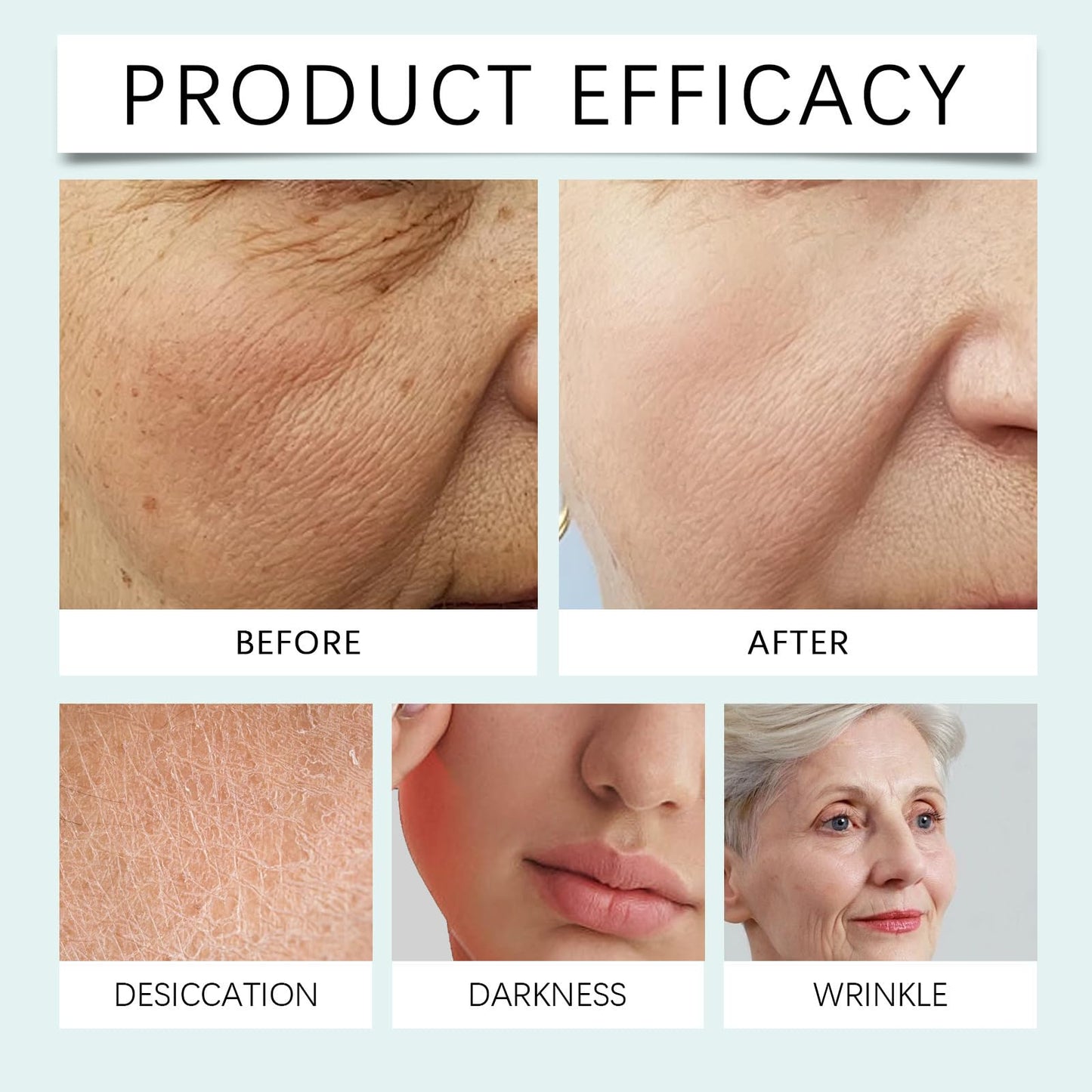 Skin Renewal Face Cream - For Melasma, Pigmentation - Supports a More Even Skin Tone for Men & Women