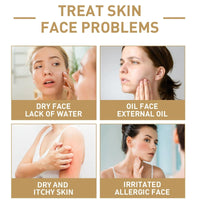 140ml Rice Water Toner,Rice Face T/oner,Rice to/ner for Women,Hydrating Ton/er,Rice Serum,Natural Moisturizer Glow Essence,Mois/turizing Soothing Tone/r,Essence Toner,Moisturizing Rice Extract