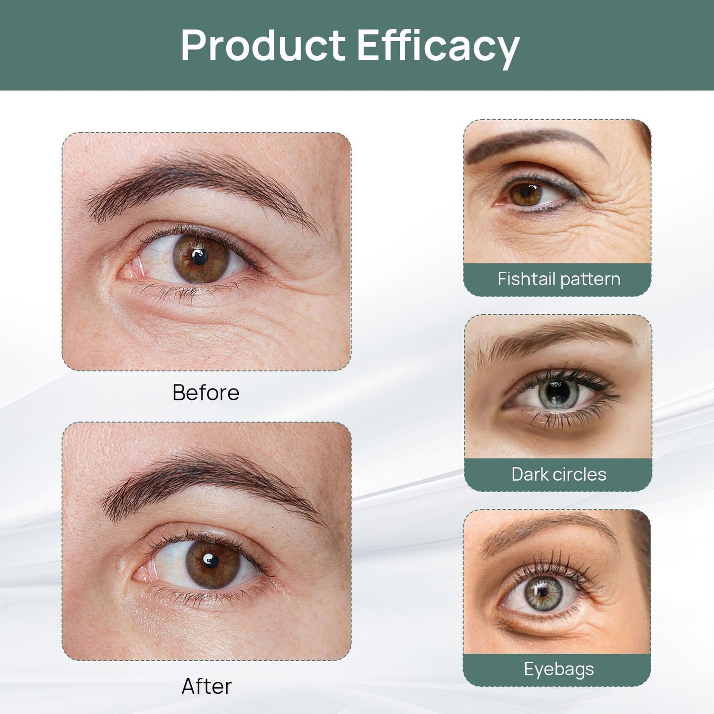 COWANIEE 6 Pcs Hyaluronic Microneedle Patches,Anti Wrinkle Patches for Puffy Eyes Bags Under Eyes