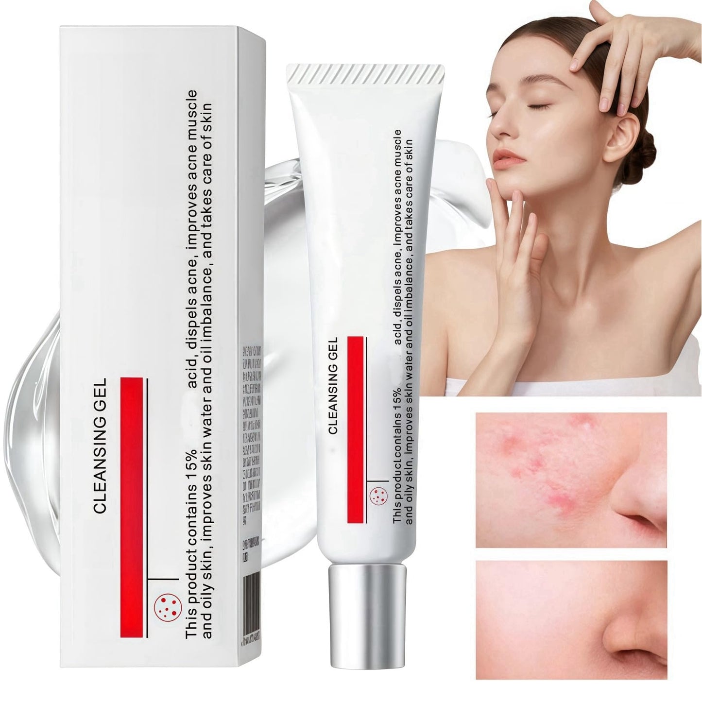 Oumun 15% Acid Acne Treatment Gel,Anti Acne Face Cream,Face Acne Treatment,Acid 15% Facial Serum Cream,Spot Treatment,Gentle Acne Cream,Spot Serum Cream for Face,Pimple Treatment Gel Cream,Face Gel for Acne