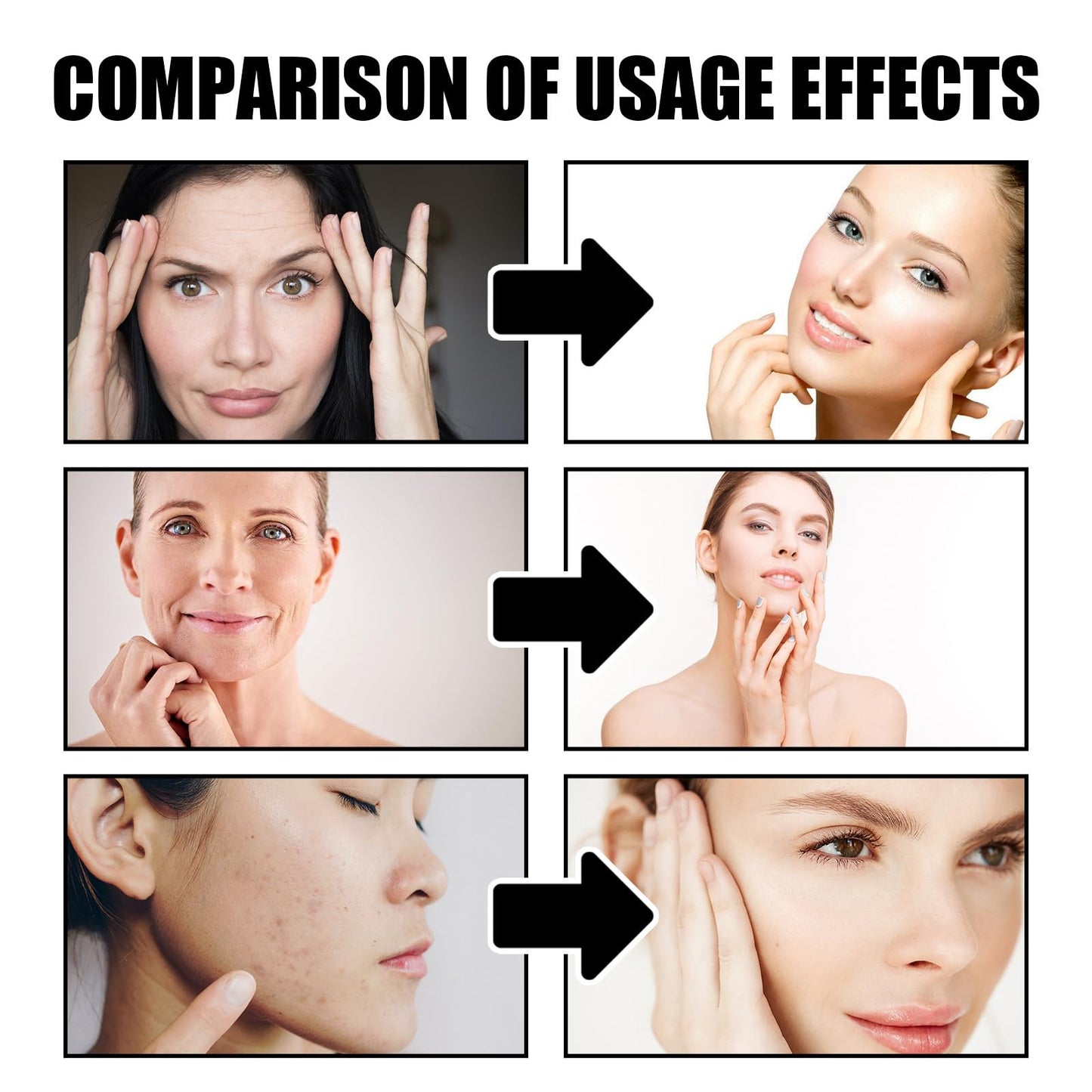 Kojic Acid Cream,Skin Lightening Cream for Anti Aging,Dark Spot Correcting Glow Serum,Dark Spot Corrector,Dark Spot Remover for Face,Spot Cream,Face Moisturizer for Women,Dark Spot Cream,Spot Gel