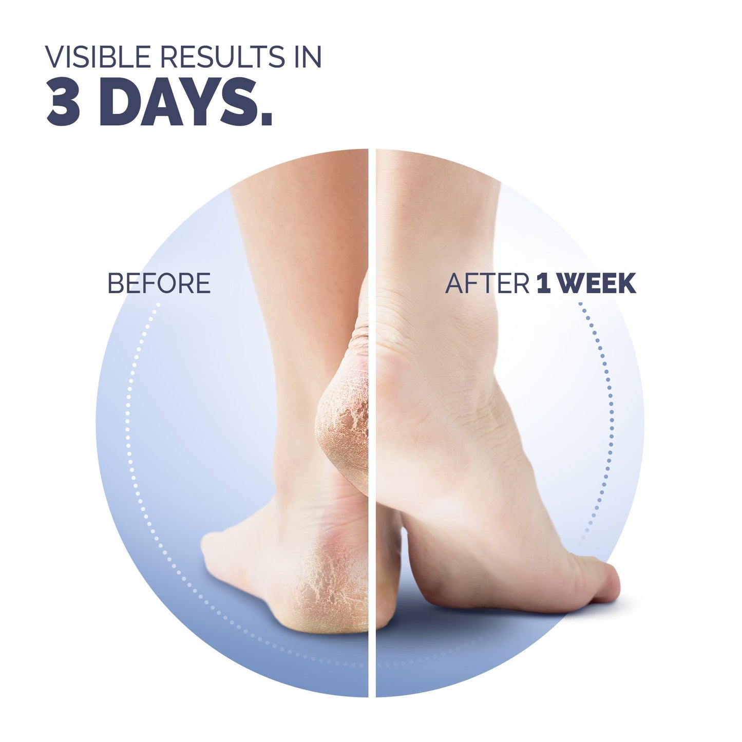 Scholl Cracked Heel Repair Cream 60 ml