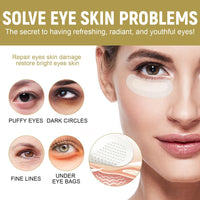 Fankayi Dissolving Micro-Needle Eye Patches,Anti Wrinkle Patches,Micro-Needle Patches for Dark Circles & Puffy Eyes,Under E-ye Gel Patches,Hydrating E-ye Patches,Hydro-gel E-ye Patches,E-ye Cooling Gel Pads