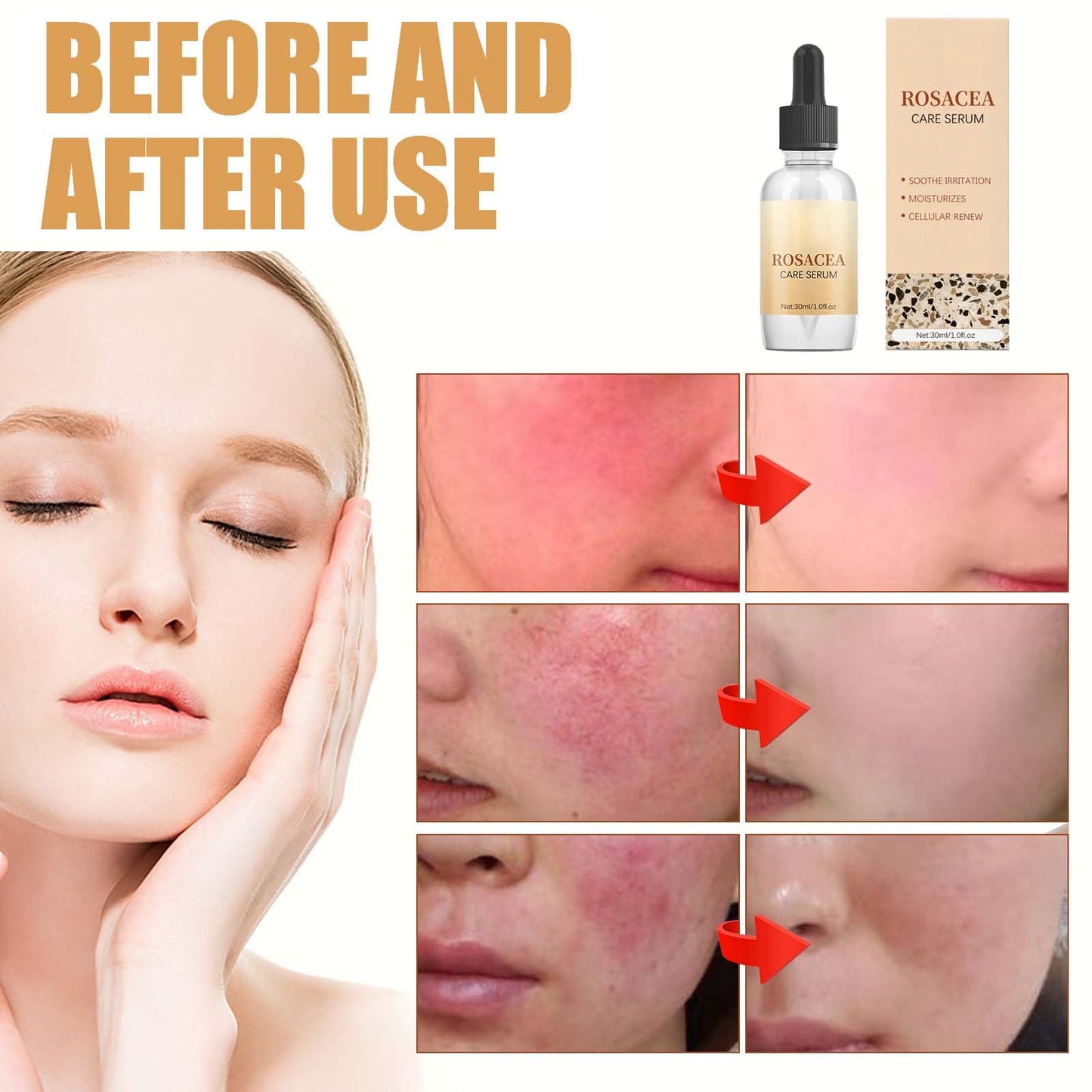 KKwoter Rosacea Face Serum Combo - Anti-Blushing & Anti-Aging with Tea Tree Oil. Moisturizes Sensitive Skin, slows down Zit & Blush Marks, Improves Elasticity. For Women & Men