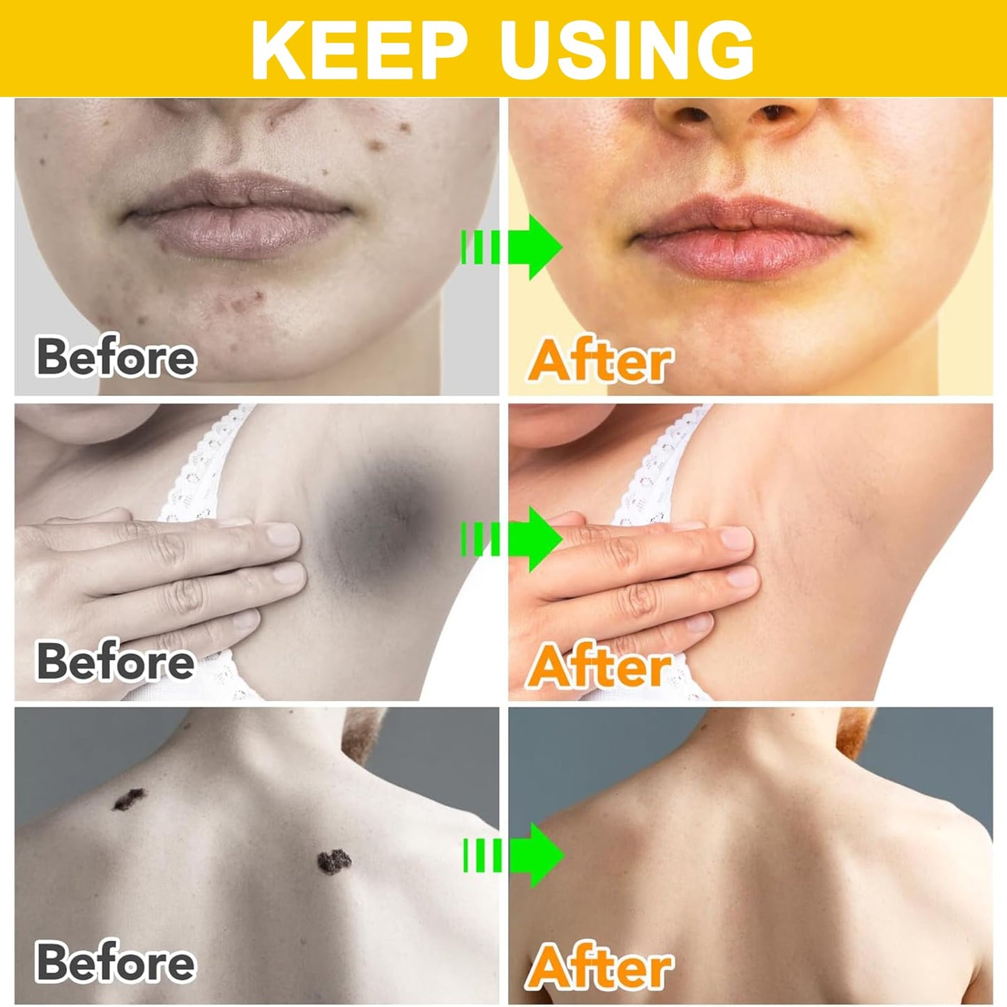 Trendyfave Bee Venom Cream, Bee Venom Skin Treatment Cream, Skin Repair, Enriched with Bee Venom & Natural Extracts, Body Moisturiser, Revitalises Skin, Suitable for All Skin Types, 2Pcs