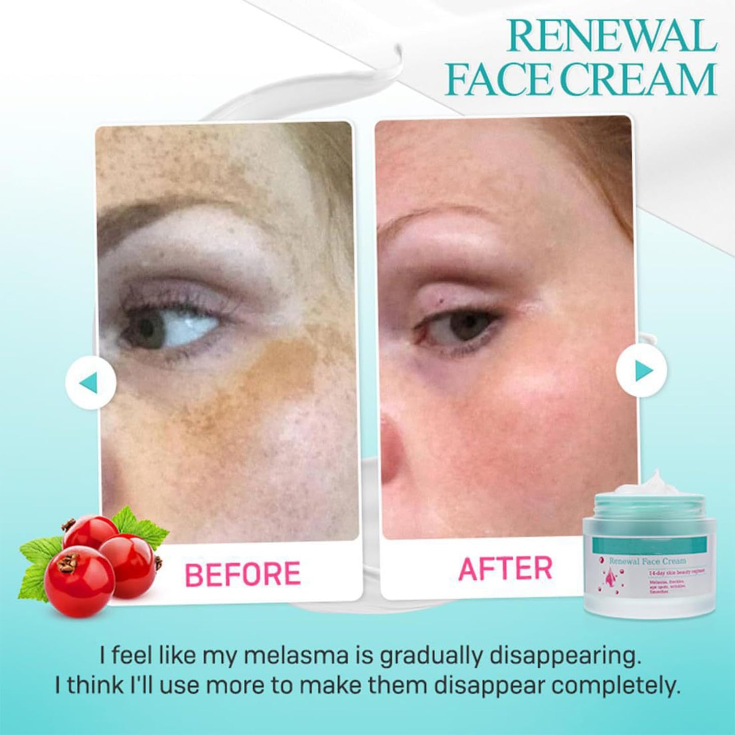 Skin Renewal Face Cream, Melasma Cream, Pigmentation Removal Cream For Men & Women, Dark Spot Remover For Face - Corrector For Age Spots Sun Spots Freckles Melasma Brown Spots (2 Pack)