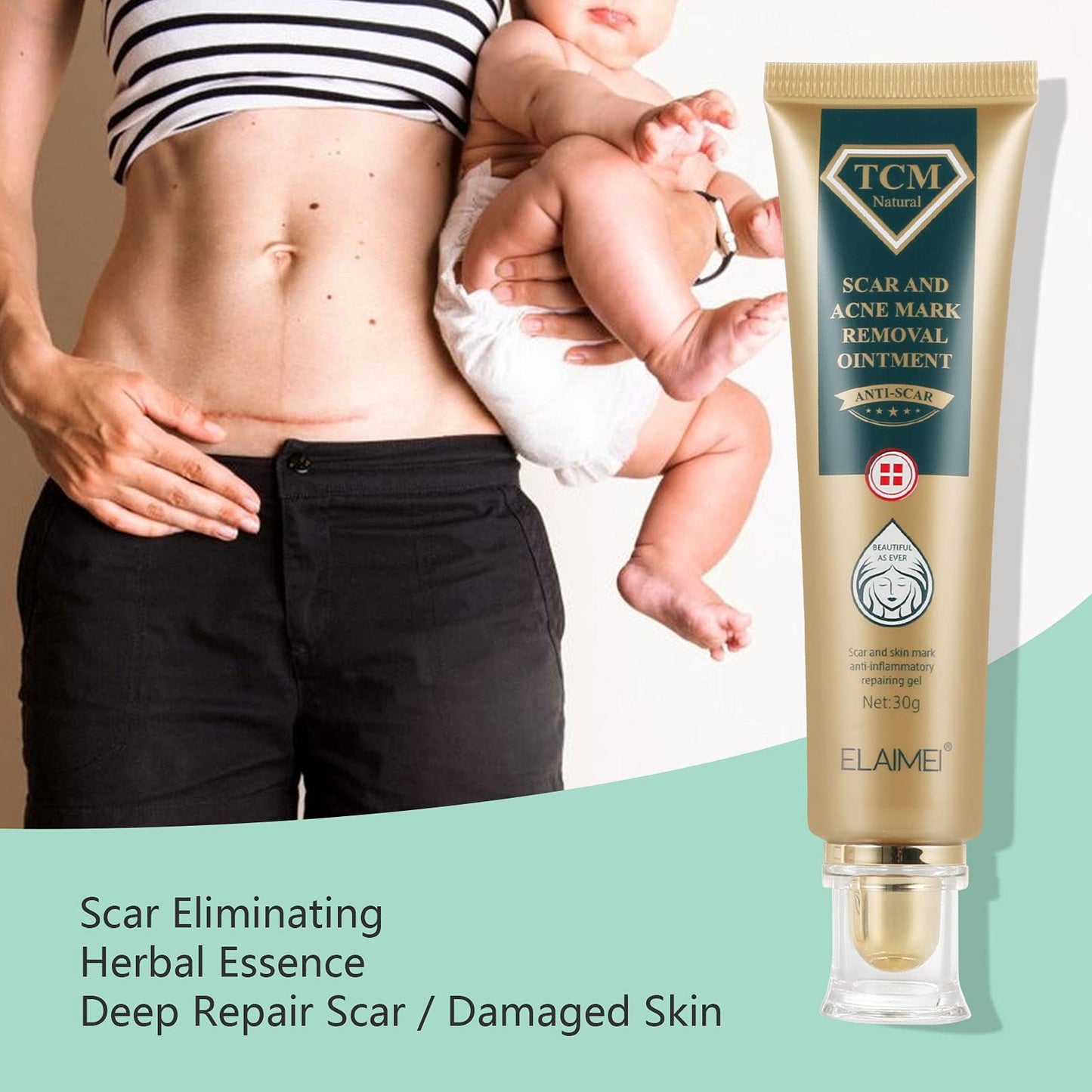 JSBNQRMZ Bump Removal Gel,30g Scar cream,Safe Non-Greasy Formula for Scars, Keloids & Piercing Bumps | Soothing Piercing Aftercare Gel,Keloid Scar, Acne Scar, New and Old Scars