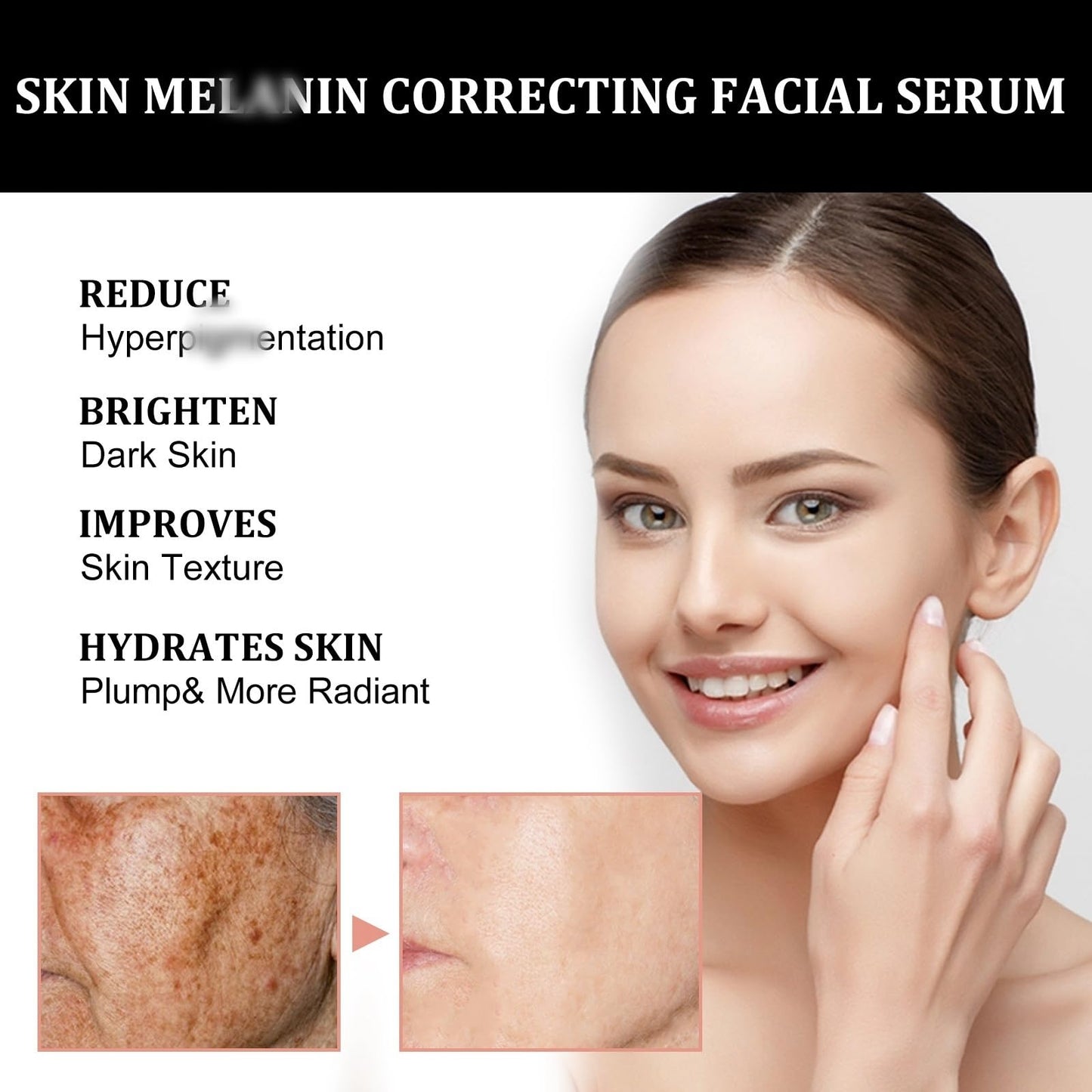 OuXing Spot Correcting Glow Serum,Hydrating & Brightening Serum,Spot Remover for Face,Skin Repairing Face Serum,Spot Treatment,Skin Lightening Cream,Freckle Removal Cre/am,Fa/ce Seru/m for Women,Sp/ot Cre/am