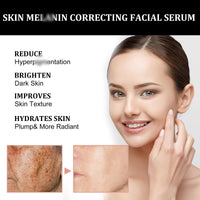OuXing Spot Correcting Glow Serum,Hydrating & Brightening Serum,Spot Remover for Face,Skin Repairing Face Serum,Spot Treatment,Skin Lightening Cream,Freckle Removal Cre/am,Fa/ce Seru/m for Women,Sp/ot Cre/am