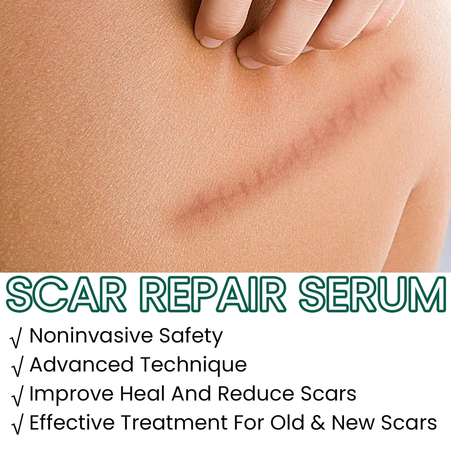 Jinjiar Scar Cream,Scar Removal Cream,Advanced Scar Gel for Old and New Scars,Skin Repair Cream for Old and New Scars,Scar Erase,Acne Scar Treatment,Scar Cream After Surgery,Scar Removalscar Cream for Face