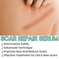 Jinjiar Scar Cream,Scar Removal Cream,Advanced Scar Gel for Old and New Scars,Skin Repair Cream for Old and New Scars,Scar Erase,Acne Scar Treatment,Scar Cream After Surgery,Scar Removalscar Cream for Face