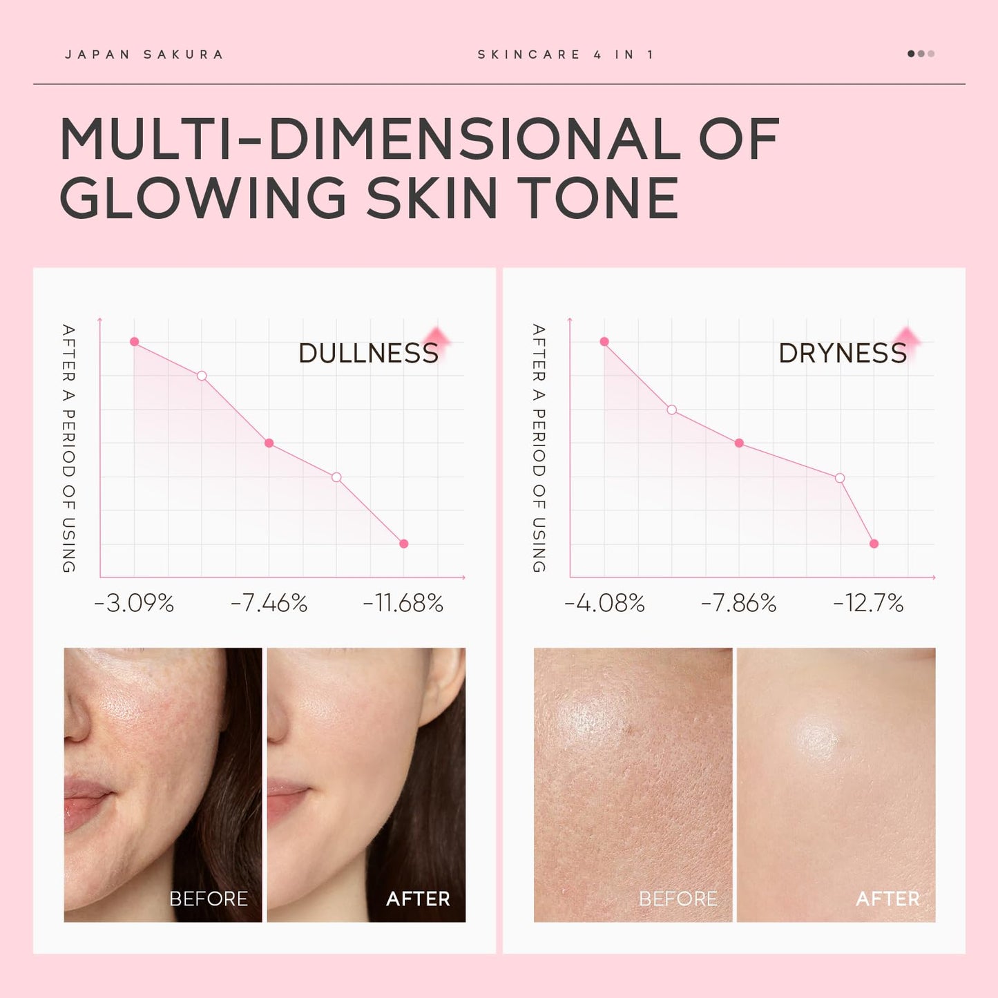 LAIKOU Sakura Skincare Set, Japanese Beauty Facial Kit for Women Teenage Girls, Cleanser, Toner, Serum, Moisturizer, Headband & Gua Sha Tool, Hydrating Facial Routine for Glowing Skin, 6PCS