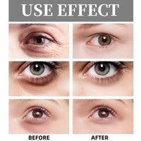 Siyinzu 2PCS Eye Balm Stick for Under Eye Bags,Balm Erases Eye Bags within Minutes,Eye Cream for Dark Circles and Puffy Eyes,Balm Eye Bags Remover,Anti Aging Eye Cream Stick,Moisturizing Firming Eye Serum