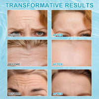 Datival Forehead Wrinkle Patches, Anti Wrinkle Patches with Aloe, Moisturizing Mask Pads, Forehead Lines Age Lines Resistant Wrinkle Remover Strips, Anti Wrinkle Masks Pads for Men and Women,12 PCS