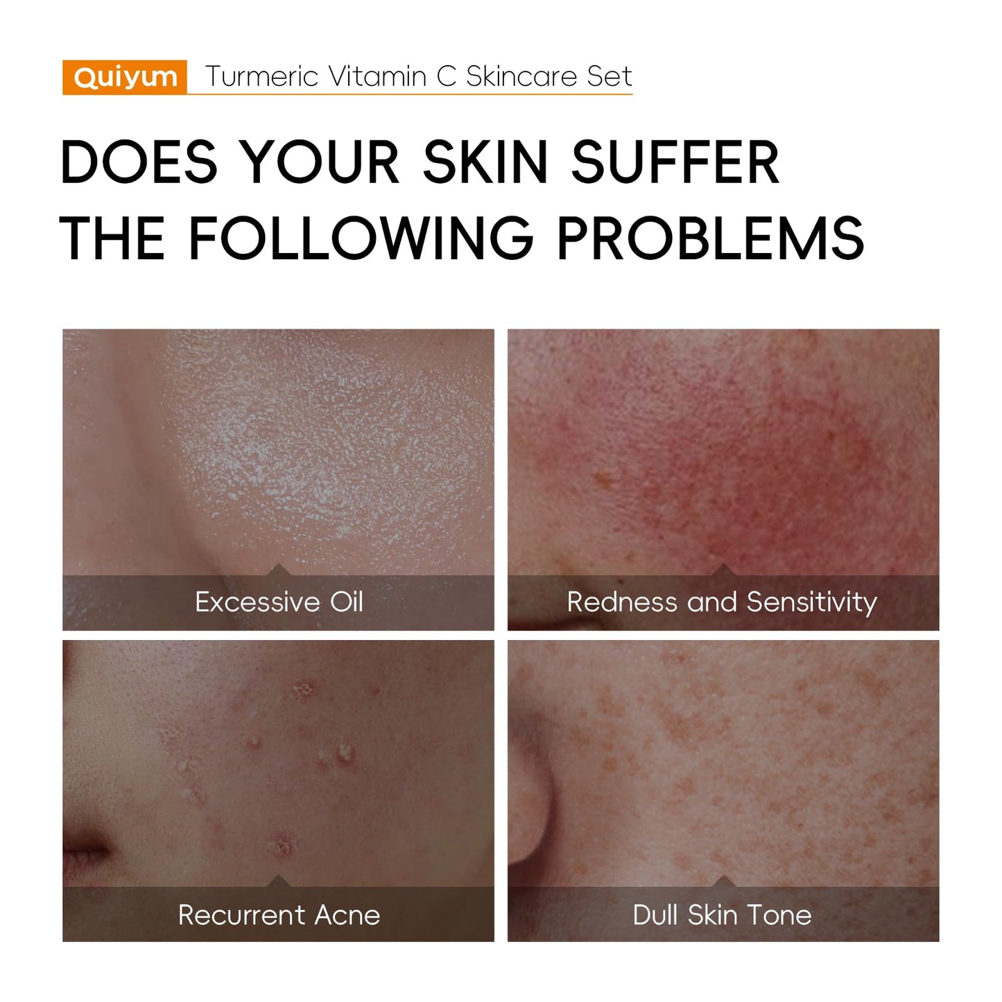 Quiyum Turmeric Vitamin C Skincare Set, Radiance, Hydrating Face & Body Care Kit, Serum,Eye Cream, Cream,Facial Oil,Handmade Soap & Clay Mask, Pamper Gift Set for Women Teenage Girls Mom Birthday