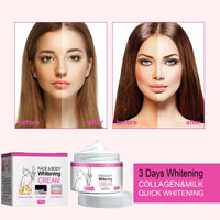 GNAUMORE Skin Whitening Cream,Skin Lightening Cream,Body Moisturiser for Whitening,Whitening Cream,Lightening Cream for Dark Skin,Whitening Anti-Freckle Moisturizing Cream,Lightening Cream for Dark Skin,2PC