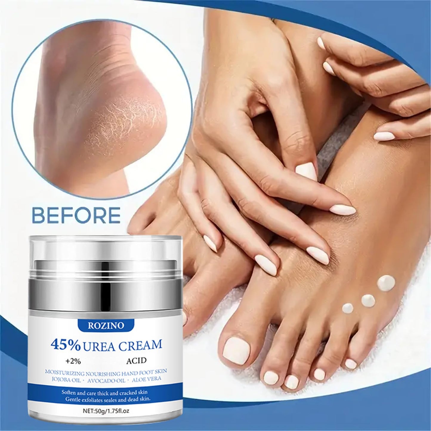 Urea Cream, 45% Urea Foot Cream, Foot Cream for Cracked Heels and Dry Skin Athletes Foot Cream Cracked Heel Repair Cream Cracked Heel Repair Cream for Feet and Hand