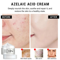 Asheyya Azelaic Acid Cream, Face Serum Skin Care Beauty with Niacinamide & Vitamin C