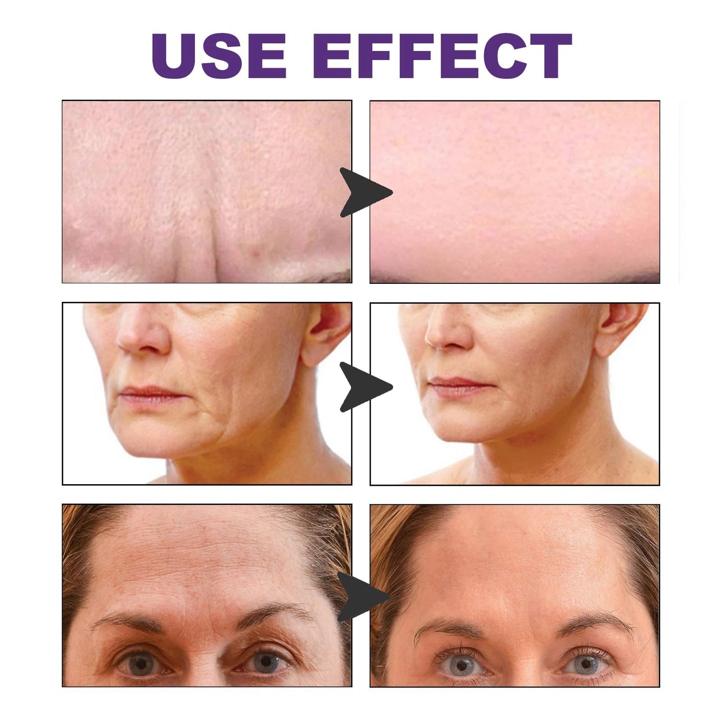 OuXing 60PCS Forehead Wrinkle Patches,Anti Wrinkles Patches,Effective Face Lift Tape for Wrinkles Facial Patches,Anti Wrinkle Patches for Firming Frownies,Face Tape for Wrinkles,Face Lifting Tape,Face Tape