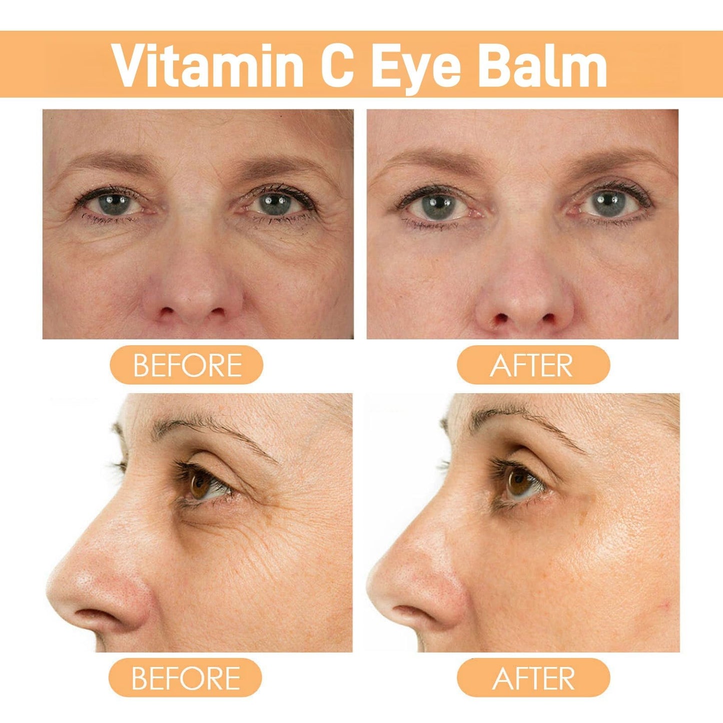 Lutein Eye Essence Oil,Intensive Hydration&Skin Repair for Eyes,Lutein Anti-Wrinkle Eye Serum Oil,Vc EyeWrinkle EssenceOil,EyeRoller for Dark Circles and Puffiness,Vitamin C LuteinEye EssenceOil