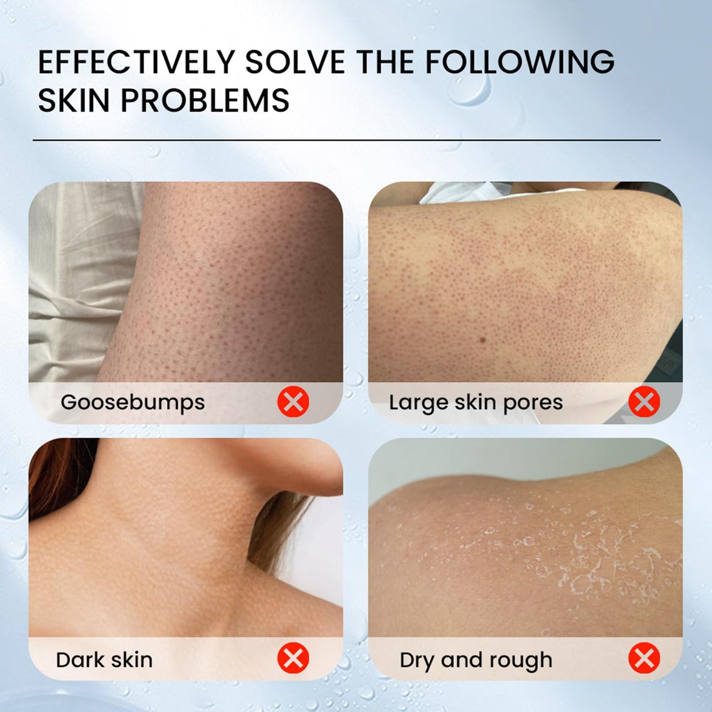 Strawberry Legs Treatment,Keratosis Pilaris Treatment,Skin Exfoliating Repair Lotion,Keratosis Pilaris Cream,Moisturizing Strawberry Skin Smooth Radiant Body Lotion,Body Care for Women Men