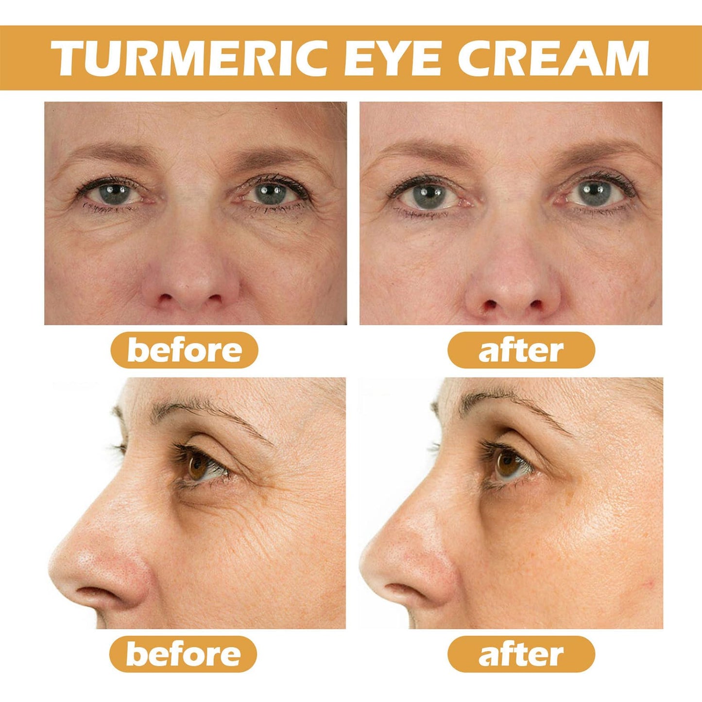 Generic Turmeric Eye Cream, Turmeric Under Eye Balm for Dark Circles, Puffiness Corrector, Brightening Eye Formula, Aging Support Cream, For Tired Eyes, Dull Skin Tone, Fine Texture Lines, Firm Feel