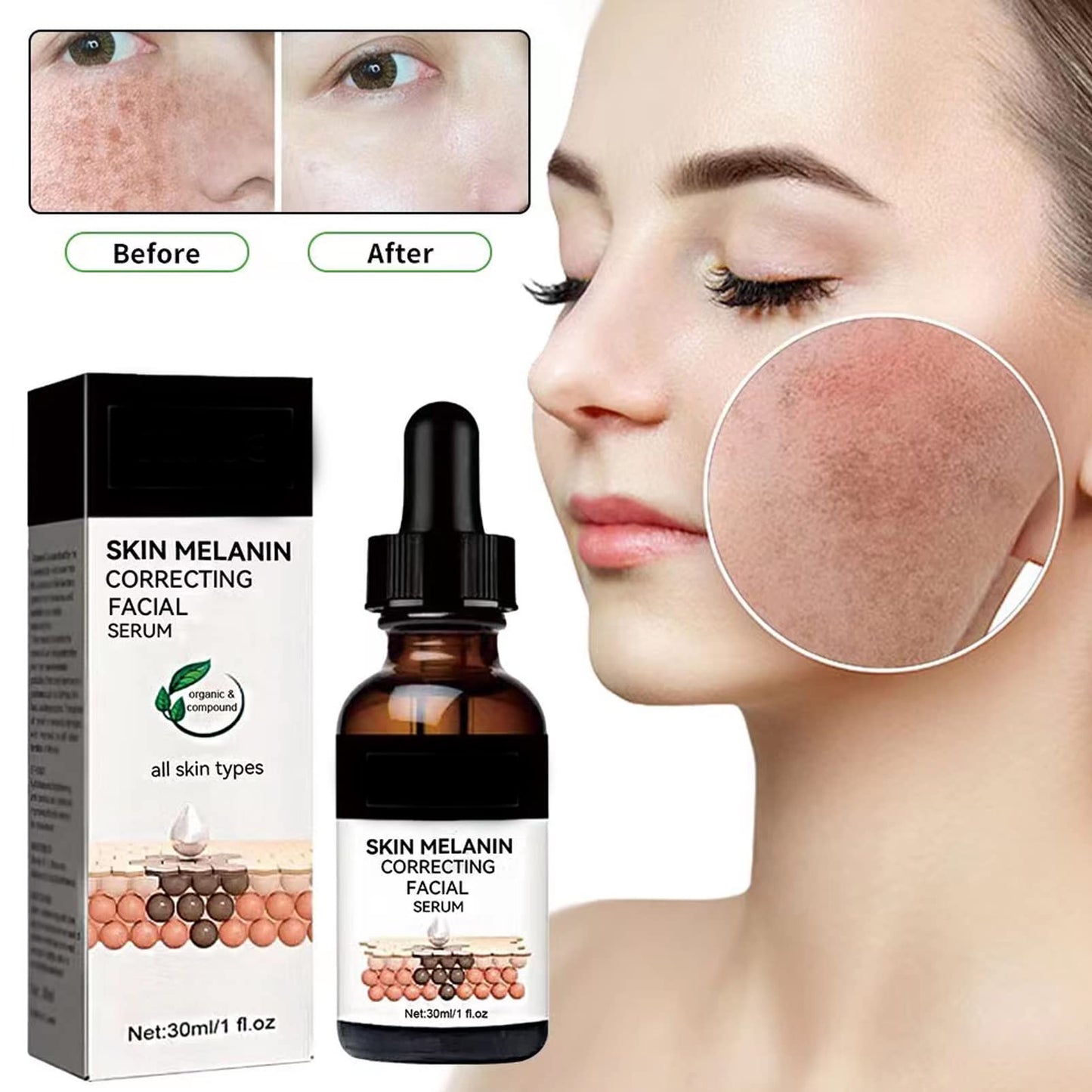 Dark Spots Correcting Facial Serum,2PCS Brightening Facial Serum,Rapid Dark Spot Correcting Serum,Improve Dry Skin & Smooth Skin,Brightening Serum,Dark Spot Remover Serum For Melanin Correcting