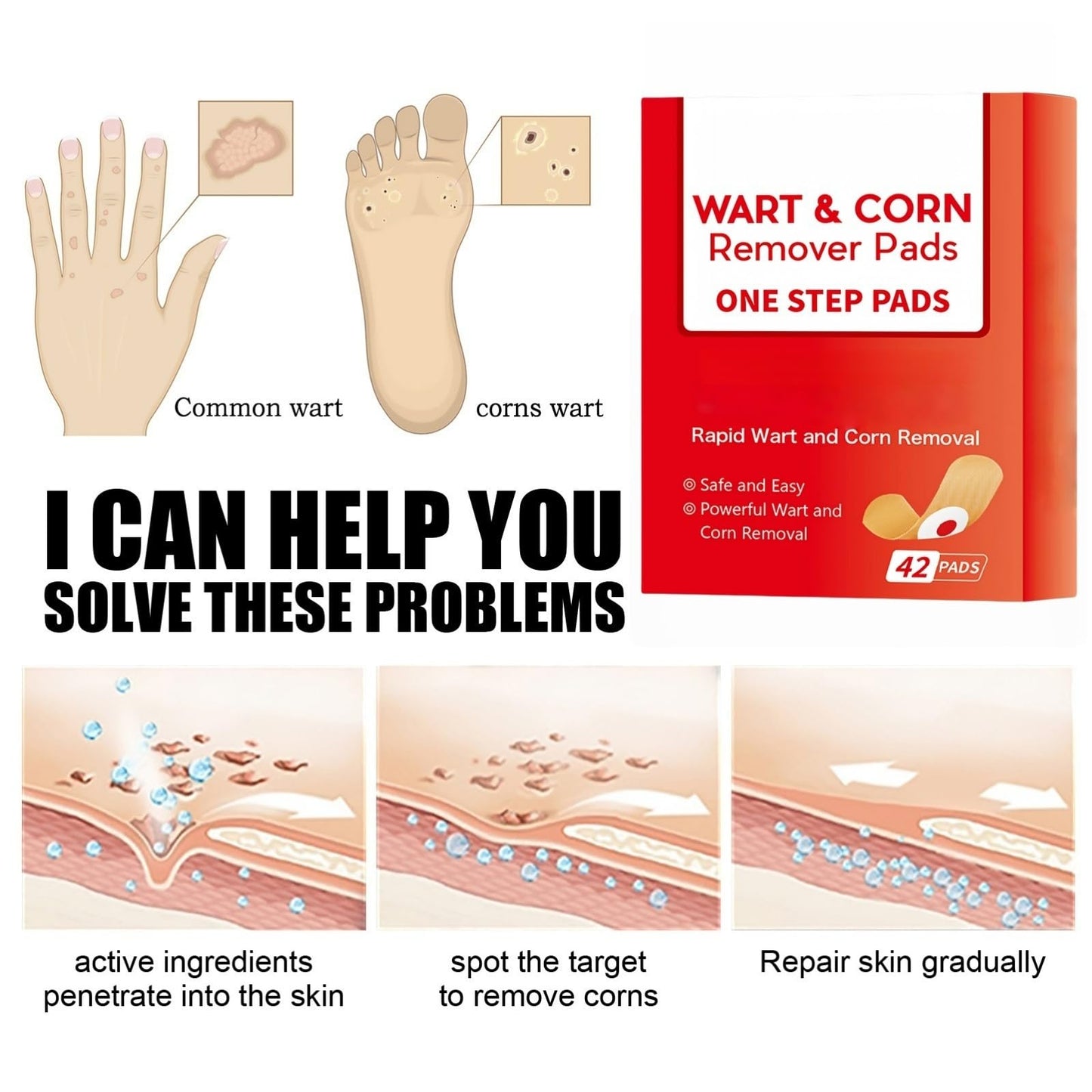 SingHao 42 Pcs Wart Treatment Patch,Wart and Corn Remover Pads,Verruca Treatment,Wart Remover Corn Plasters,Corn Remover for Feet and Hand,Effective Deep Verruca Removal Pads Patches,Corn and Callus Remover