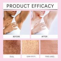 Shefave Intimate Area Brightening Gel, Brightening Body Lotion, Skin Lightening Cream for Dark Skin, Skin Bleaching Cream, Dark Spot Corrector, Body Moisturiser for Men & Women, Brighten Uneven Skin Tone