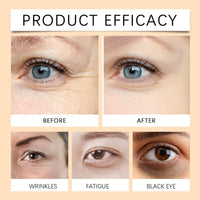Turmeric Retinol Eye Cream Stick,Eye Cream Stick for Dark Circles and Puffy Eyes,Dark Circle Eye Cream Stick,Anti Wrinkle Eye Cream,Firming Eye Cream Stick,Retinol Eye Cream Stick to Reduce Fine Lines