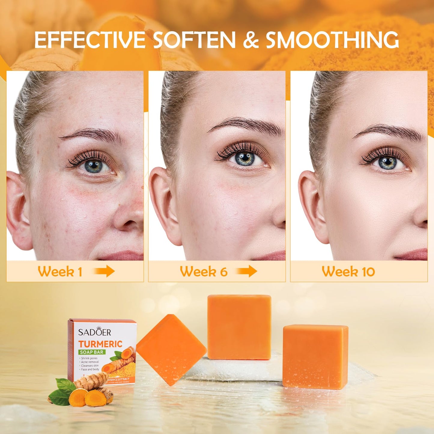 Lustwieta Turmeric Soap Turmeric Acne Dark Spots Smooth Skin, Handmade Soap Bar Pure Soap Bar For Face & Body, Skincare Face Care, Moisturizing, Blackhead Corrector Remover, Moisturizing Erase Fine Lines(1 PCS)