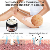140G Strawberry Legs Treatment, Keratosis Pilaris Cream,Moisturizing Strawberry Skin Treatment for Chicken Skin, Exfoliating Body Cream,Skin Smooth Radiant Skin Care,For All Skin Types