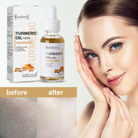 Turmeric Serum Dark Spot Removal, Ksndurn Turmeric Face Serums Oil, Turmeric Dark Spot Corrector Serum for Face & Body, Heals Scars, Moisturizing, Skin Brightening Serum for Dark Spots