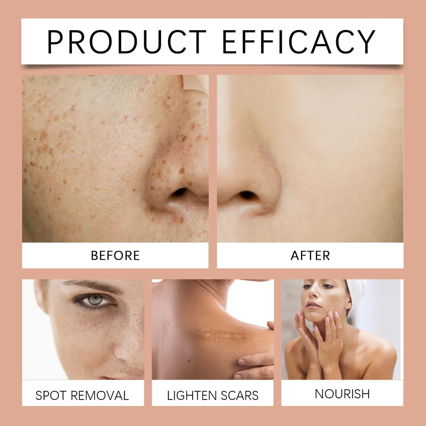 Dark Spot Remover Serum,D/ark S/pot Corrector Daily Face S/erum,Da/rk Sp/ot Correcting Glow Se/rum,Dark Spo/t Remover,Spot Treatment,Moisturiser Fa/ce Women,Face Oils for Women,Hydrating Serum