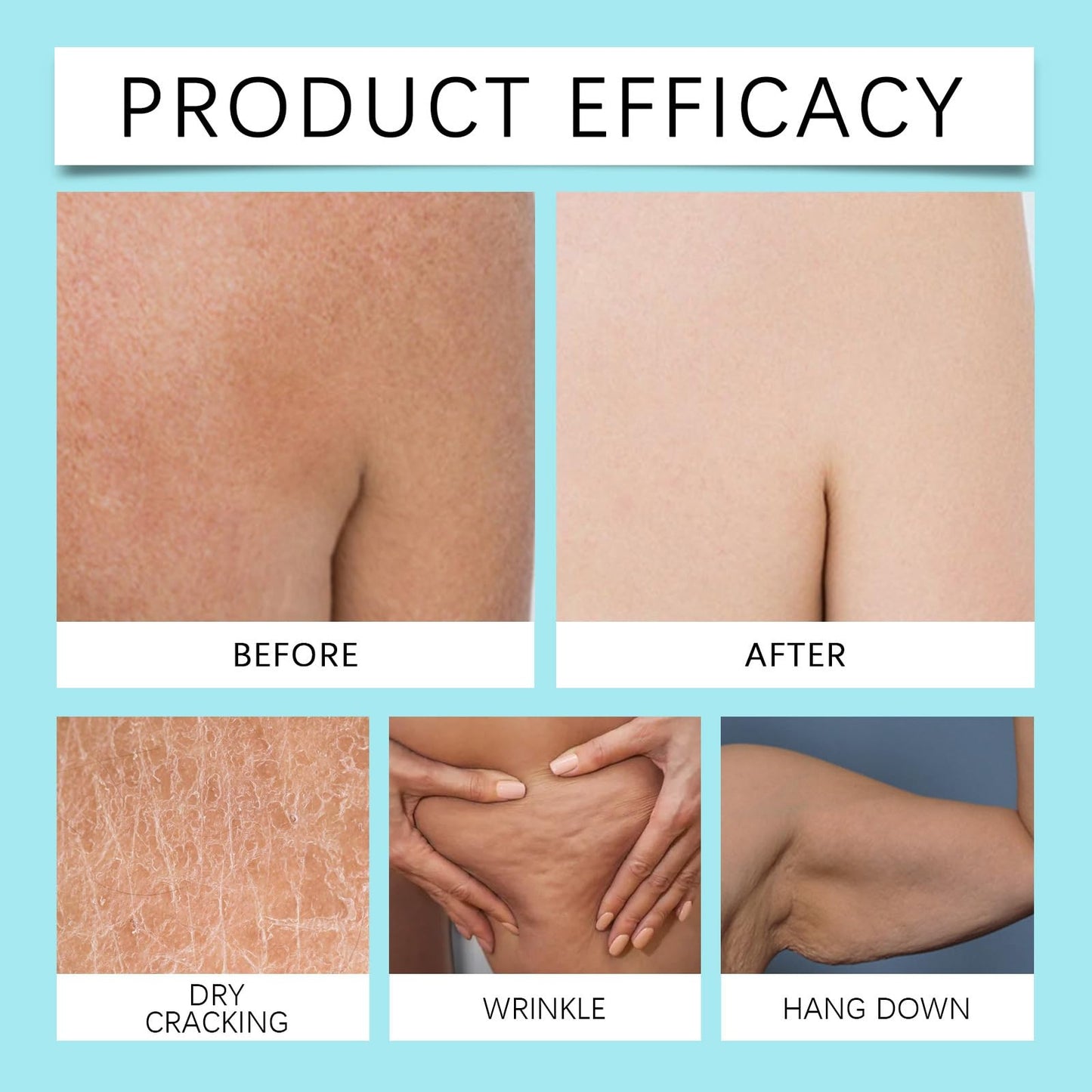Crepe Be Body Gone Souffle,Firming Neck Cream,Ultra Hydrating Crepe Skin Firm/ing Cream for Neck/Legs/Arms,Ne/ck Fir/ming Tightening Cre/am,Cr/epe Be Ne/ck Gone C/ream,Body Souffle for Women