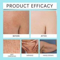 Crepe Be Body Gone Souffle,Firming Neck Cream,Ultra Hydrating Crepe Skin Firm/ing Cream for Neck/Legs/Arms,Ne/ck Fir/ming Tightening Cre/am,Cr/epe Be Ne/ck Gone C/ream,Body Souffle for Women