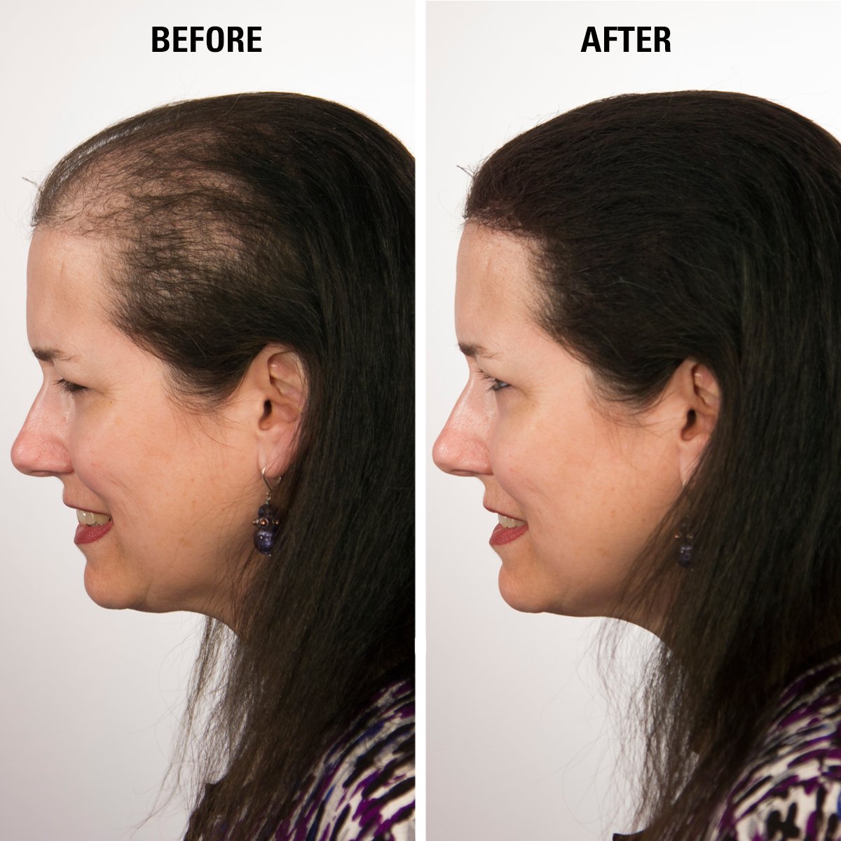 Infinity Hair Building Fibers To Conceal Thinning For The Appearance Of Thicker, Fuller Women & Men - Auburn 28G