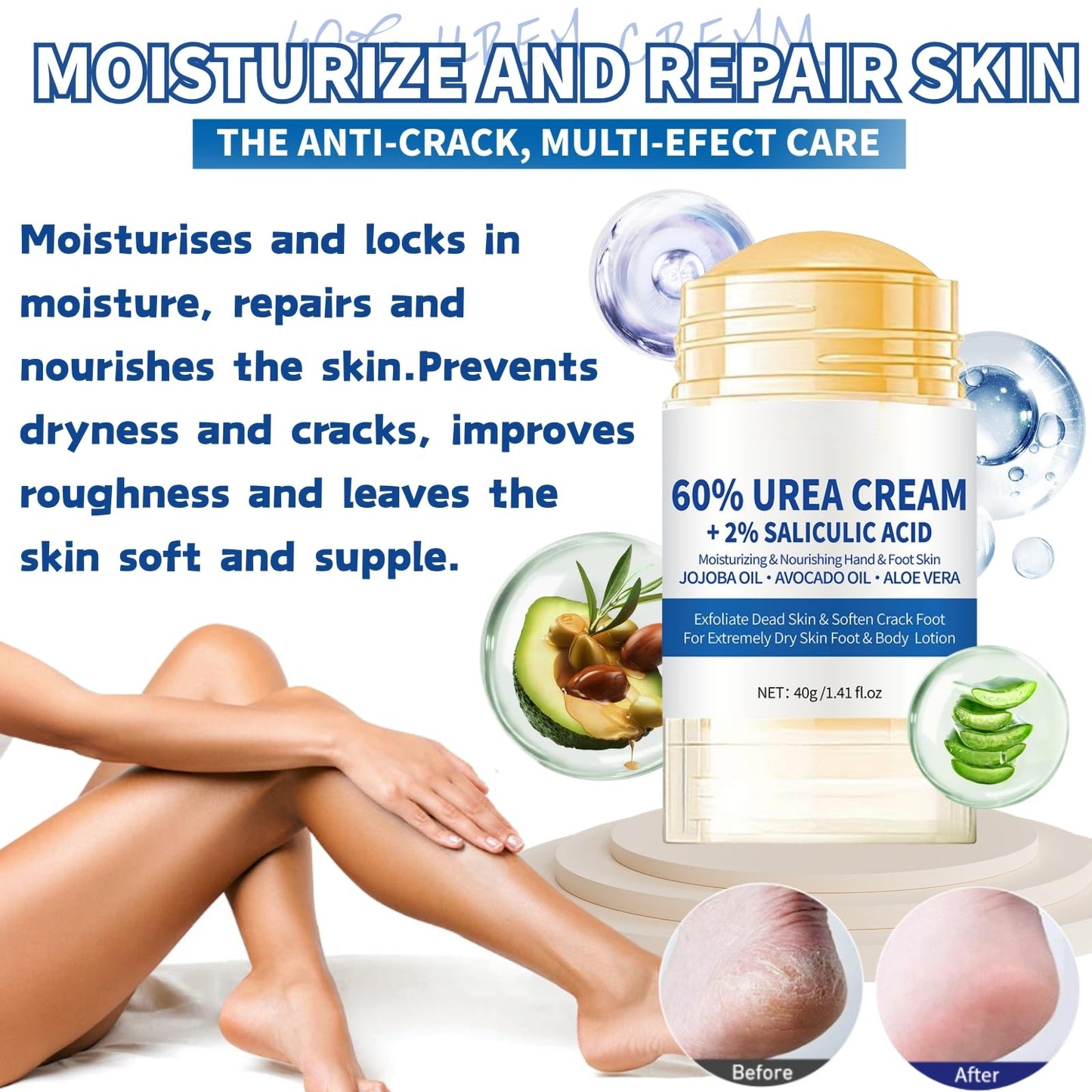 60% Urea Cream - Urea Cream 60 Percent for Feet - Cracked Heel Repair Cream - Ure_a Foot Cream Stick Plus 2% Salicylic Acid For Calluses - Foot Crea_m For Cracked Heels And Dry Skin 1pc
