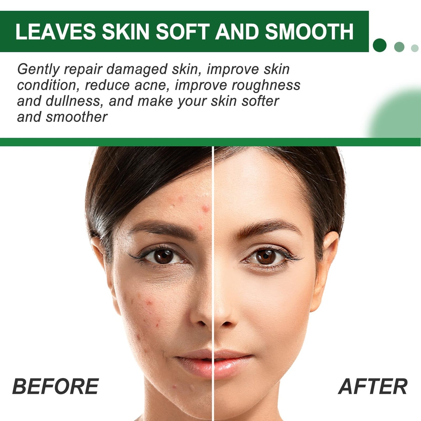 Siyinzu Dark Spot Remover Cream for Face & Body,Anti Aging Fac/e Cream,Dark Spot Remover,Freckle Removel Cre/am,Age Spot Remover for F/ace,Dark Spot Corrector Firming Fa/ce Moisturiser,Moisturiser Face Women