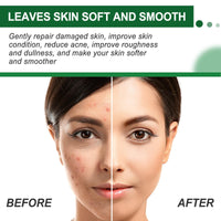 Siyinzu Dark Spot Remover Cream for Face & Body,Anti Aging Fac/e Cream,Dark Spot Remover,Freckle Removel Cre/am,Age Spot Remover for F/ace,Dark Spot Corrector Firming Fa/ce Moisturiser,Moisturiser Face Women