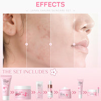 ISBEAUSOLS Sakura Skin Care Sets & Kits - Skin Care Gift Set for Teenage Girls - Facial Kits for Women Gifts - Face Care Sets Cleanser, Serum, Cream,Eye Cream,Lip Mask,Mud Mask,Sleeping Mask