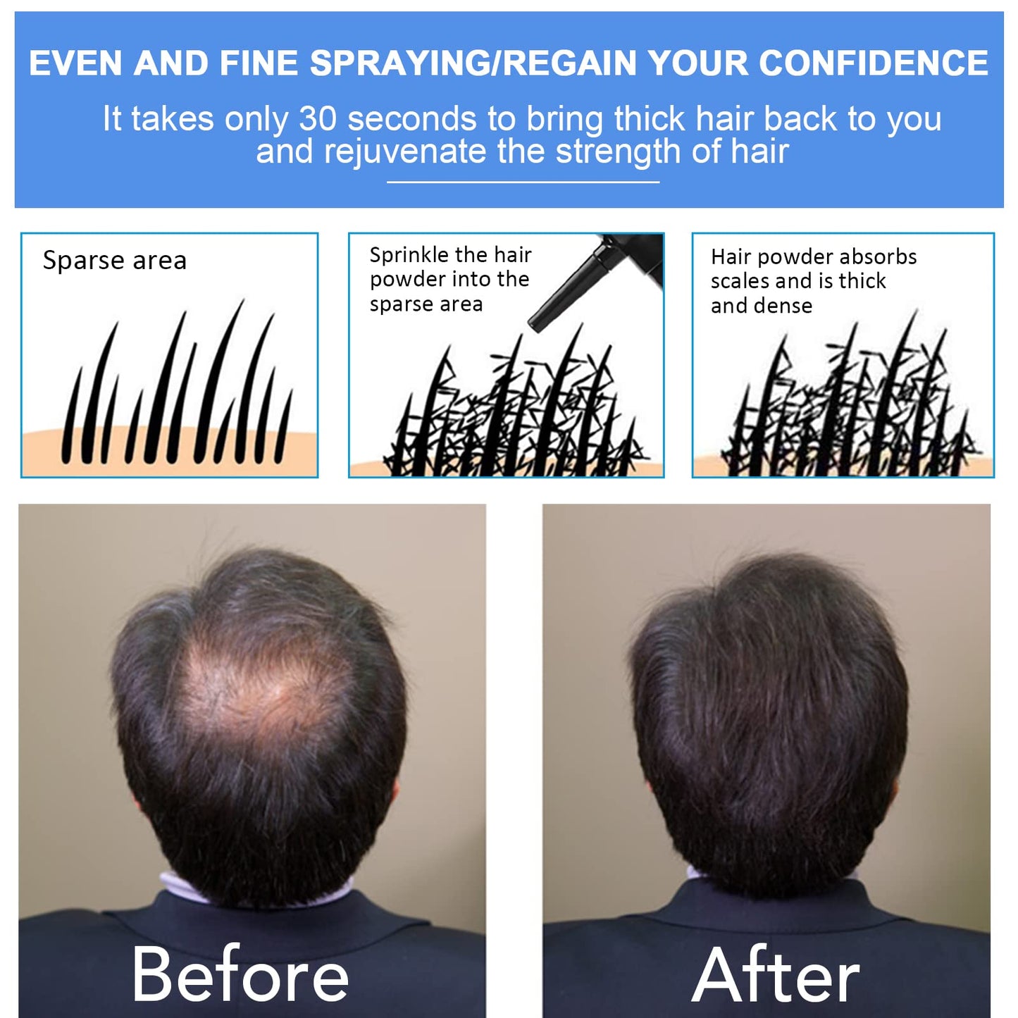 Professional Quality Hair Fibres, Hair Fibres Black for Thinning Hair, Completely Conceals Hair Loss in 15 Seconds, Undetectable & Natural, Hair Loss Product for Women and Men(Black)